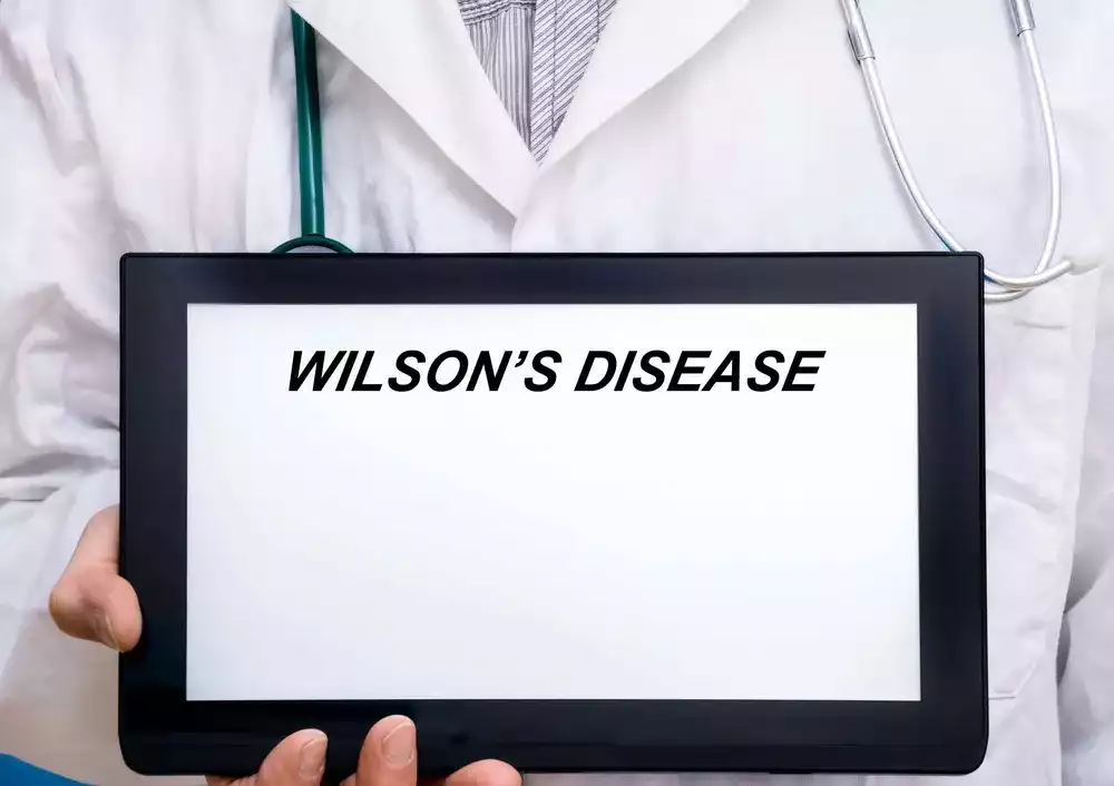 wilson hastalığı