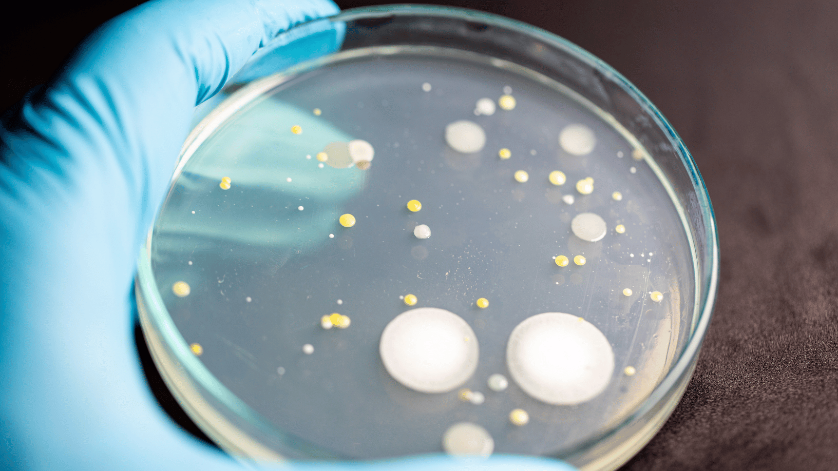 Anti HBs Nedir? Anti HBs Yüksekliği ve Düşüklüğü