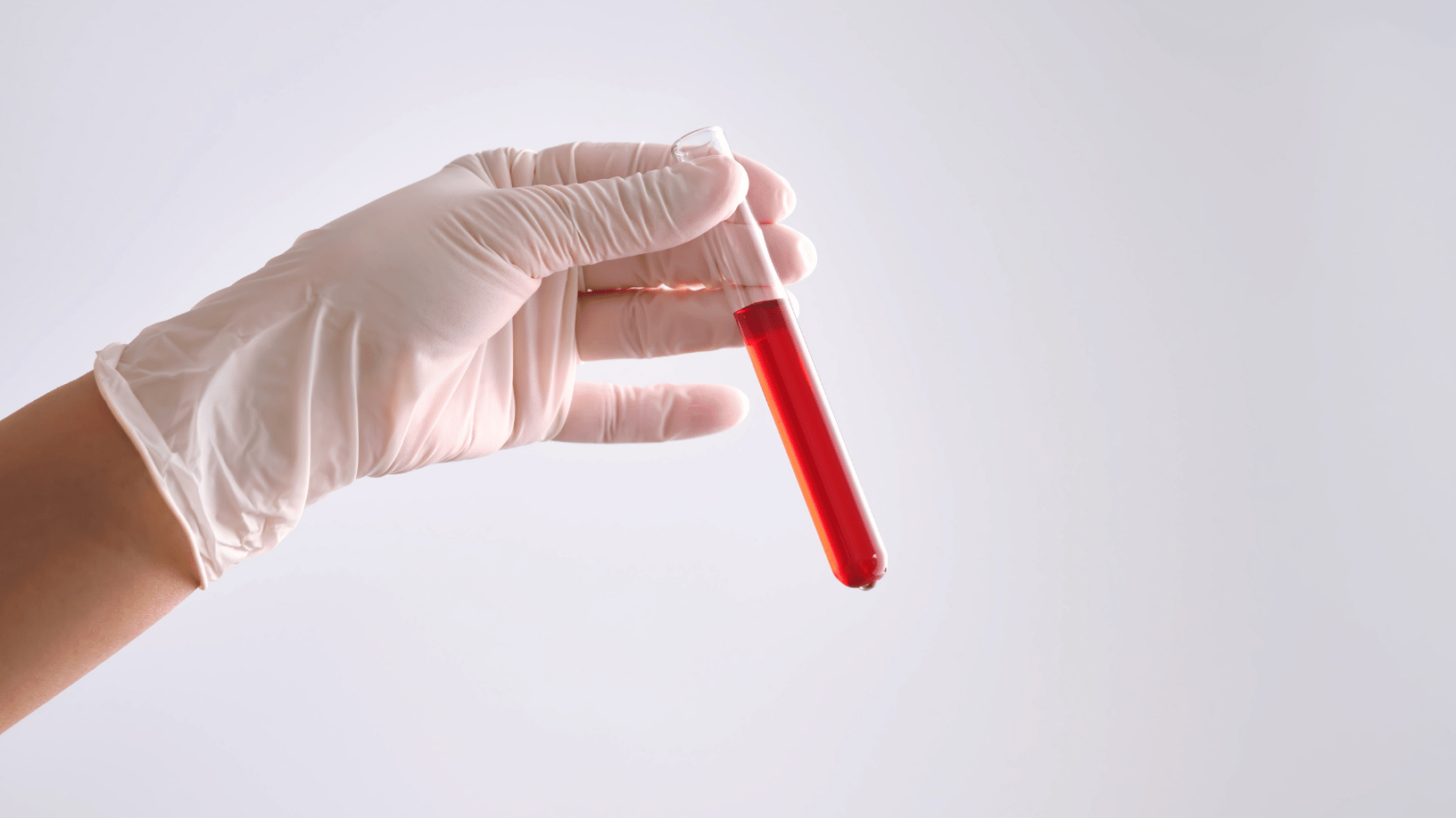 Bilirubin Nedir? Bilirubin Yüksekliği ve Düşüklüğü